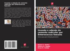 Couverture de Invasão e adesão do cemento radicular por Enterococcus faecalis