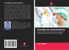 Bookcover of Cirurgia do pneumotórax