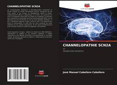 Buchcover von CHANNELOPATHIE SCN2A