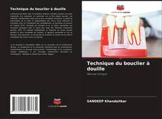 Buchcover von Technique du bouclier à douille