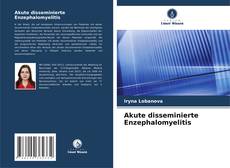 Copertina di Akute disseminierte Enzephalomyelitis
