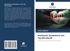 Kontinente Zystostomie vom Typ Mitrofanoff的封面