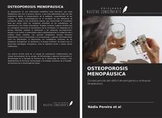 Couverture de OSTEOPOROSIS MENOPÁUSICA