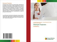 Capa do livro de Doenças Tropicais: 