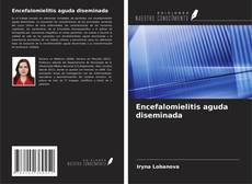 Bookcover of Encefalomielitis aguda diseminada