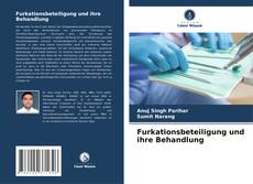 Обложка Furkationsbeteiligung und ihre Behandlung