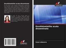 Bookcover of Encefalomielite acuta disseminata