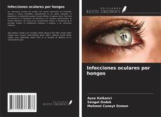 Capa do livro de Infecciones oculares por hongos 