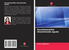 Borítókép a  Encefalomielite disseminada aguda - hoz