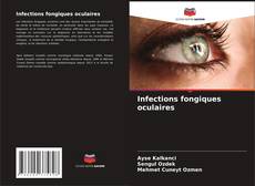 Copertina di Infections fongiques oculaires
