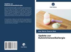 Copertina di Update zur Kuhmilcheiweißallergie