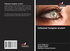 Buchcover von Infezioni fungine oculari