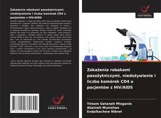 Bookcover of Zakażenia robakami pasożytniczymi, niedożywienie i liczba komórek CD4 u pacjentów z HIV/AIDS