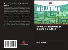 Couverture de Névus dysplasiques et mélanome cutané