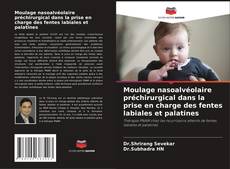 Moulage nasoalvéolaire préchirurgical dans la prise en charge des fentes labiales et palatines的封面