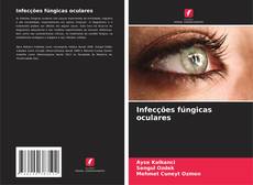 Couverture de Infecções fúngicas oculares
