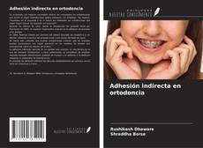 Couverture de Adhesión indirecta en ortodoncia