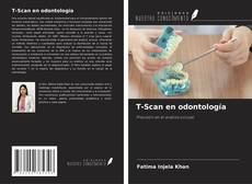 Couverture de T-Scan en odontología