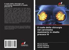 Buchcover von Il ruolo della chirurgia nel carcinoma mammario in stadio precoce IV