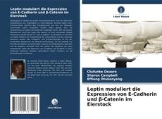 Buchcover von Leptin moduliert die Expression von E-Cadherin und β-Catenin im Eierstock