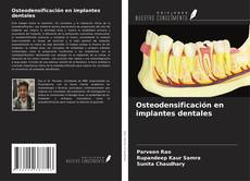 Capa do livro de Osteodensificación en implantes dentales 