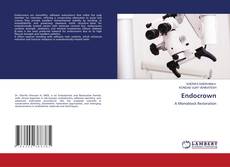 Bookcover of Endocrown