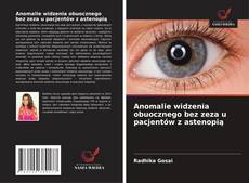 Обложка Anomalie widzenia obuocznego bez zeza u pacjentów z astenopią
