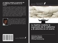 Couverture de La leptina modula la expresión de E-cadherina y β-catenina en el ovario