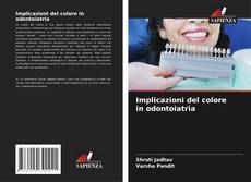 Bookcover of Implicazioni del colore in odontoiatria