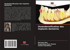 Osséodensification des implants dentaires kitap kapağı