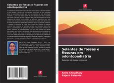 Couverture de Selantes de fossas e fissuras em odontopediatria