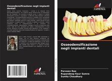 Osseodensificazione negli impianti dentali的封面