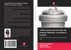 Bookcover of "Attachments de Precisão em Prótese Dentária: Conceitos e Prática"