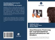 Buchcover von Geschlossene Fixierung bei suprakondylären Humerusfrakturen bei Kindern