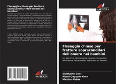 Обложка Fissaggio chiuso per fratture sopracondilari dell'omero nei bambini