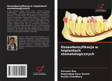 Buchcover von Osseodensyfikacja w implantach stomatologicznych