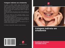 Bookcover of Colagem indireta em ortodontia