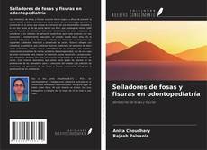 Обложка Selladores de fosas y fisuras en odontopediatría