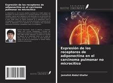 Couverture de Expresión de los receptores de adiponectina en el carcinoma pulmonar no microcítico