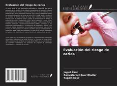 Couverture de Evaluación del riesgo de caries