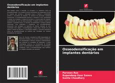 Buchcover von Osseodensificação em implantes dentários