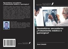 Borítókép a  Neumotórax secundario: ¿Tratamiento médico o quirúrgico? - hoz