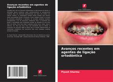 Buchcover von Avanços recentes em agentes de ligação ortodôntica