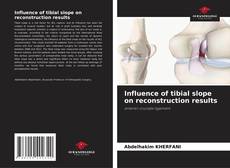 Influence of tibial slope on reconstruction results kitap kapağı