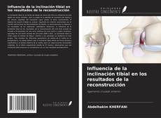 Copertina di Influencia de la inclinación tibial en los resultados de la reconstrucción