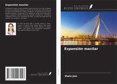 Copertina di Expansión maxilar