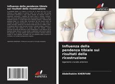 Bookcover of Influenza della pendenza tibiale sui risultati della ricostruzione
