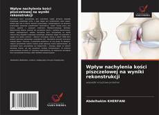 Capa do livro de Wpływ nachylenia kości piszczelowej na wyniki rekonstrukcji 