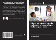 Copertina di Cáncer de ovario: estudio molecular e inmunológico de la angiogénesis