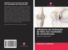 Influência da inclinação da tíbia nos resultados da reconstrução的封面